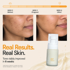 Brightening Face Milk Serum
