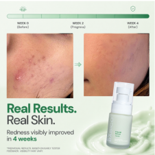 Calming Face Milk Serum